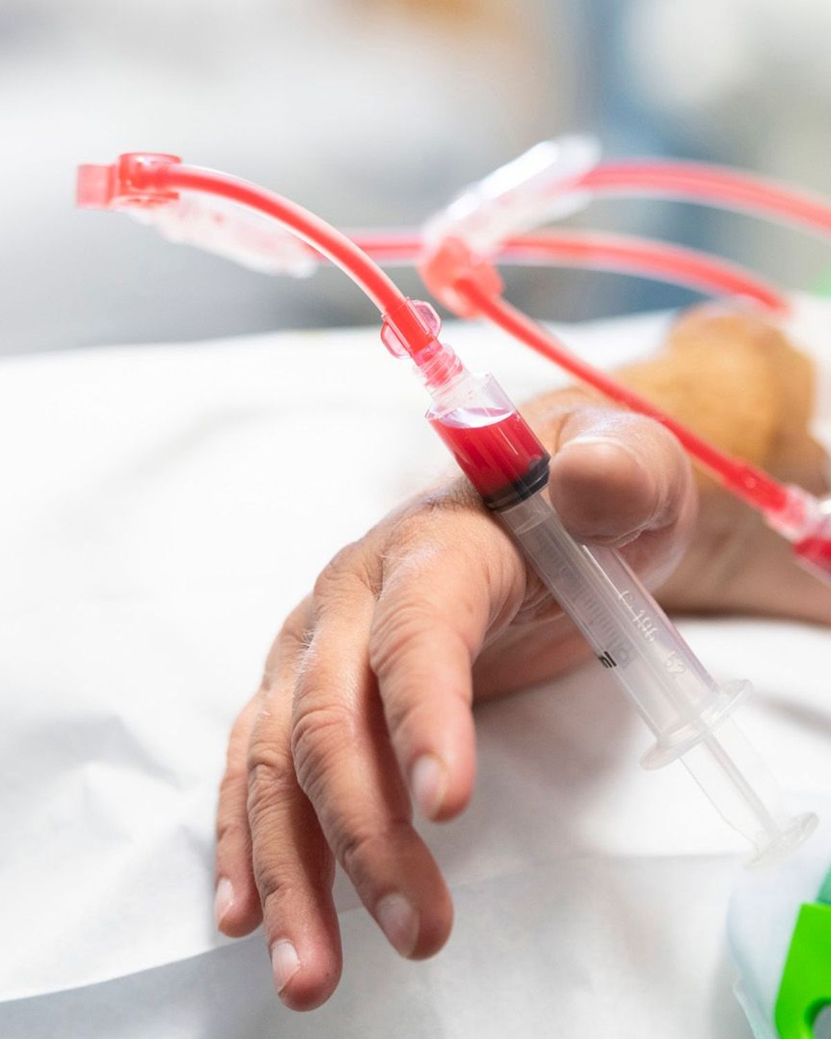 dialysevervoer dialysevervoer